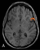 ���� ��������, Brain branding