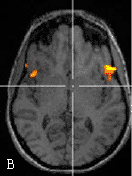 ���� ��������, Brain branding